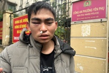 Tài xế xe Lexus hành hung nam shipper: Hành vi có tính chất côn đồ?