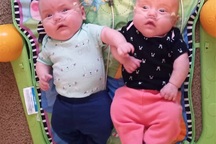 Cặp song sinh sống sót kỳ diệu: Sinh non ở tuần 22, nặng 0,45kg