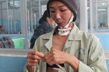 Người đàn ông suốt 11 năm không ăn bằng miệng, thở bằng ống