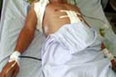 Cứu sống bệnh nhân có con dao dài 15cm trong dạ dày