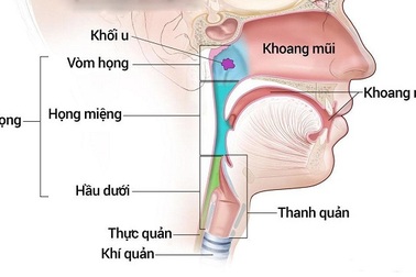 Mách bạn một số dấu hiệu cảnh báo ung thư tai mũi họng