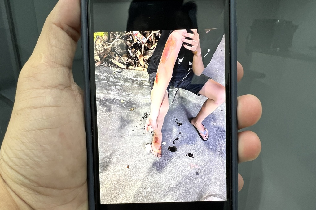 Làm hố ga nhô cao chờ nâng đường, nhiều người bị té ngã ở TPHCM - 2