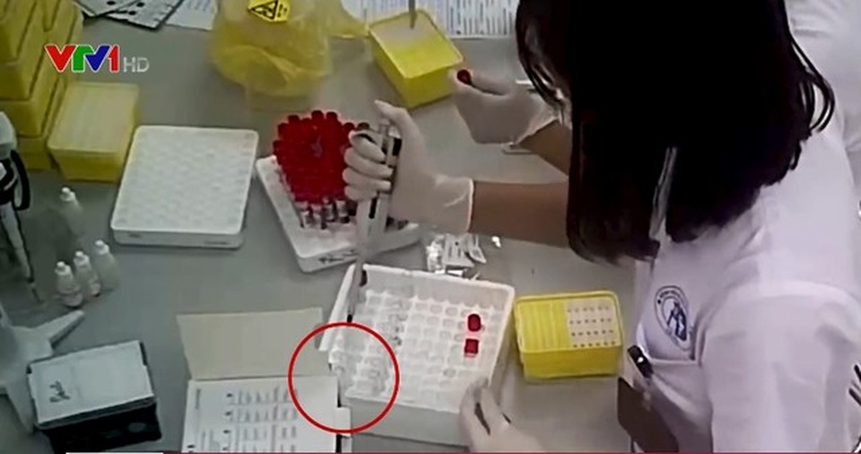 Kết quả thanh tra ban đầu vụ cắt đôi test nhanh HIV, viêm gan B tại Bệnh viện Xanh Pôn - 1 Kết quả thanh tra ban đầu vụ cắt đôi test nhanh HIV, viêm gan B tại Bệnh viện Xanh Pôn - 1