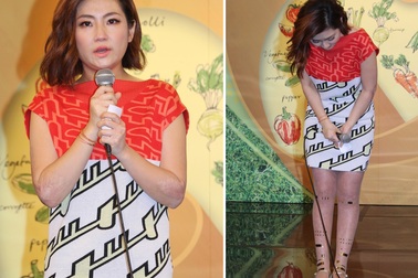 Nữ ca sĩ bị bỏng Selina cúi đầu cảm tạ fan sau tuyên bố ly dị