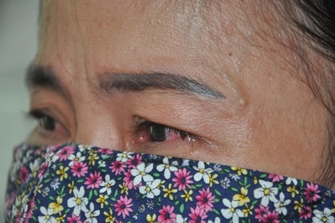 Thương người mẹ goá đôi mắt đỏ hoe cầu xin bạn đọc cứu con