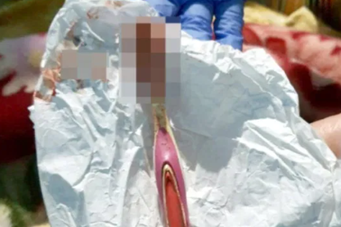 Người đàn ông nuốt chửng bàn chải trong khi đánh răng