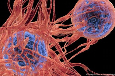 Trọng lực bằng 0 giết chết tế bào ung thư