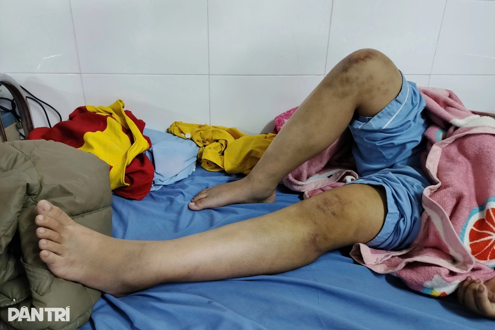 Bốn giờ bạo hành kinh hoàng và cú nhảy tìm đường sống của bé gái 12 tuổi - 5