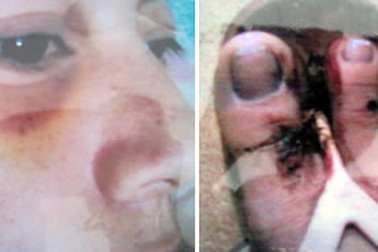 Thầy giáo bị tố đánh đập vợ dã man  