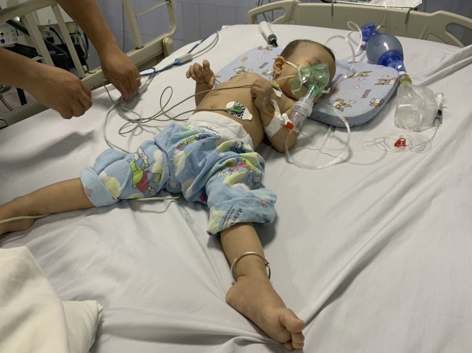 Quặn lòng cảnh bé hơn 1 tuổi co giật từng cơn trong đau đớn - 3 Quặn lòng cảnh bé hơn 1 tuổi co giật từng cơn trong đau đớn - 3