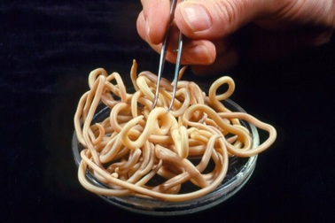 Trứng giun ký sinh sẽ sớm được bán ở Châu Âu