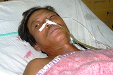 TT-Huế: Cứu sống một nông dân bị trâu húc lòi ruột