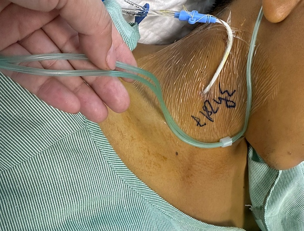 Ăn xôi màu tím, 2 người trong một nhà đi viện cấp cứu vì bị tan máu - 1 Ăn xôi màu tím, 2 người trong một nhà đi viện cấp cứu vì bị tan máu - 1