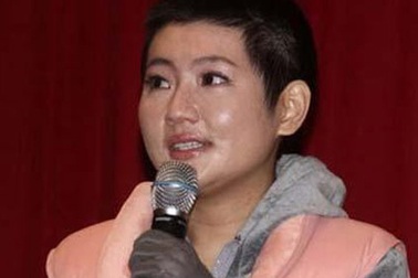 Nữ diễn viên bị bỏng Selina được bồi thường 2 triệu đô Sing