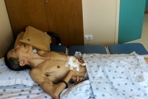 Bộ Y tế kết luận chuyên môn vụ bệnh nhân tai biến, gia đình đòi bồi thường 31,5 tỷ