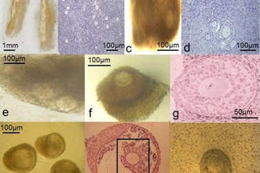 Tạo thành công noãn người trong phòng thí nghiệm