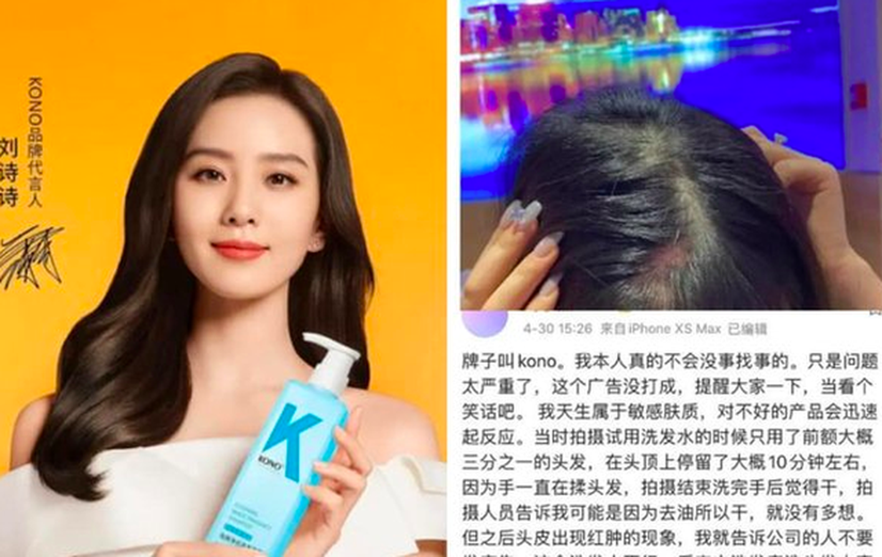 Lưu Thi Thi bị tố quảng cáo cho dầu gội đầu kém chất lượng