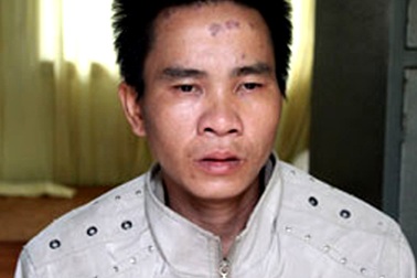 Cán bộ kế toán trường nghiện ma túy, dính HIV