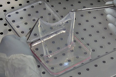 Da nhân tạo có thể được... in để hỗ trợ chữa trị bệnh nhân bị bỏng