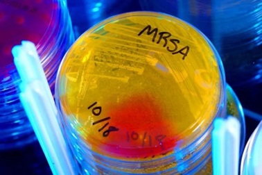 Phát hiện kháng sinh mạnh gấp 100 lần, mang hy vọng mới cho y học