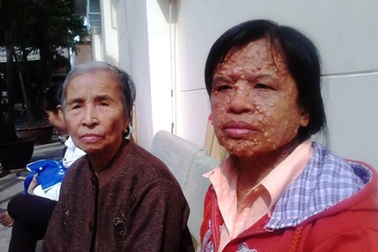 Hơn 16 triệu đồng đến với người phụ nữ sống cùng hàng trăm cái bướu