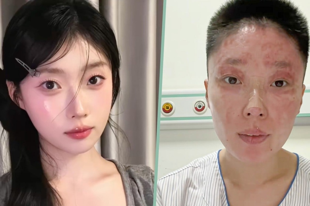 Bỏng nặng suýt mất tất cả, cựu mẫu gây sốt với nghề mới - 1 Bỏng nặng suýt mất tất cả, cựu mẫu gây sốt với nghề mới - 1
