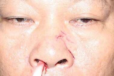 Thông báo cắt điện, nhân viên điện lực bị đánh nhập viện