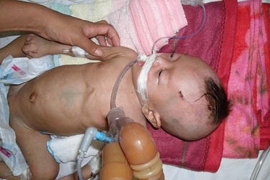 Phận hẩm hiu của bé 3 tháng tuổi không cha, bị ngộ độc thuốc trừ sâu