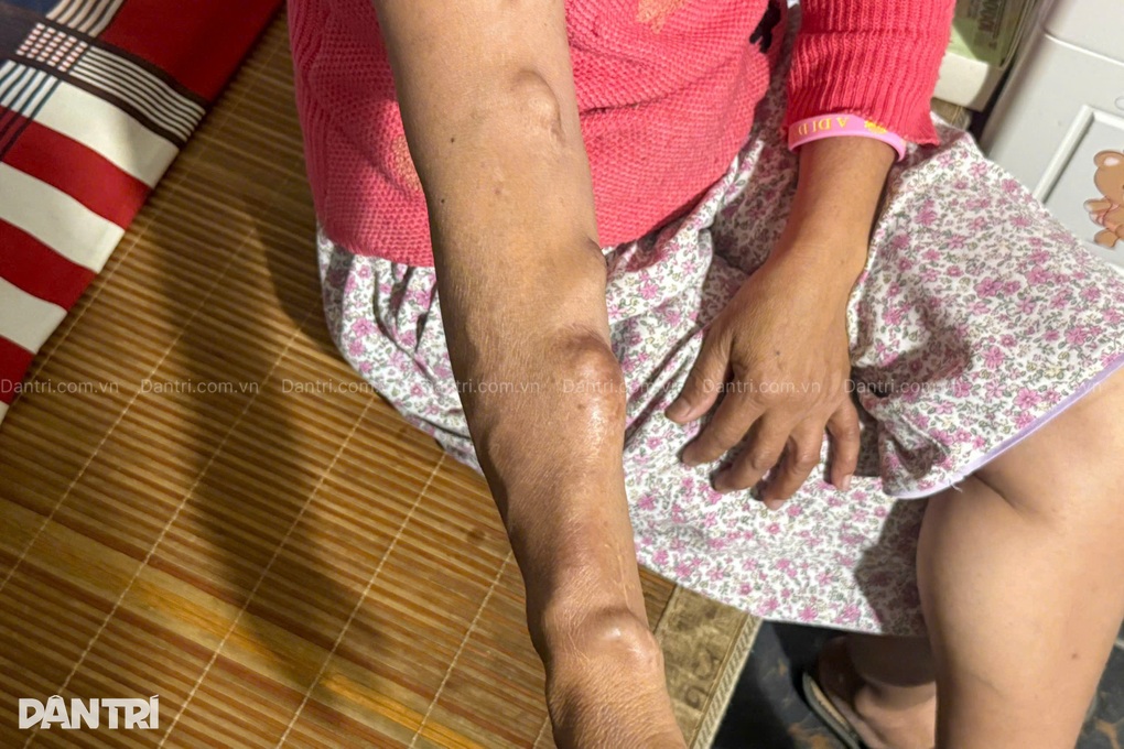 Người phụ nữ nghèo 13 năm bệnh nặng, mong được sống để báo hiếu mẹ - 3 Người phụ nữ nghèo 13 năm bệnh nặng, mong được sống để báo hiếu mẹ - 3