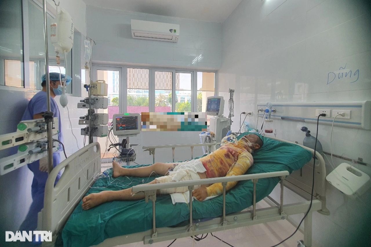 Bapa dalam keadaan kritikal akibat melecur elektrik, tidak dapat melihat muka bayi yang baru lahir - 3 Người cha nguy kịch vì bỏng điện, chưa kịp nhìn mặt con mới sinh - 3