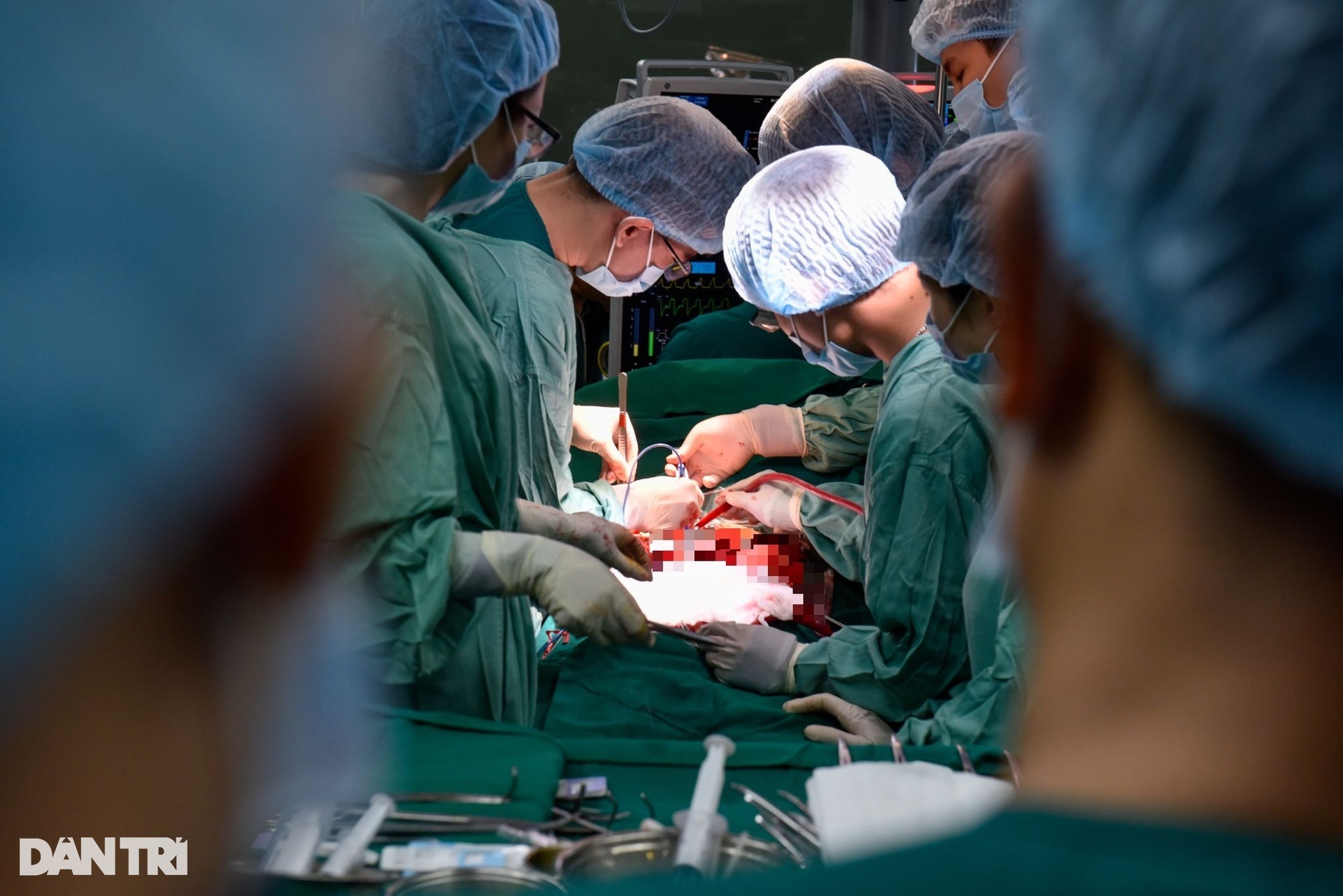 50 năm sau thống nhất, Việt Nam chói sáng trên bản đồ ghép tạng thế giới - 21 50 năm sau thống nhất, Việt Nam chói sáng trên bản đồ ghép tạng thế giới - 21