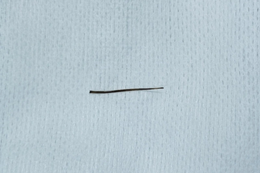 Thủng ruột vì thứ hay gặp trong mâm cơm