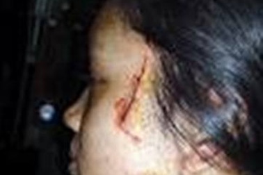 Nữ sinh lớp 9 dùng dao lam để... phòng vệ 