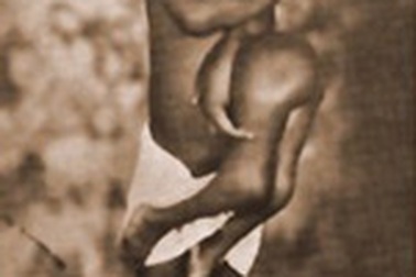 Người 4 chân, 3 tay