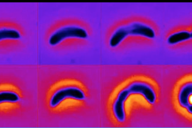 Vi khuẩn đã biết thay hình đổi dạng để tránh thuốc kháng sinh?