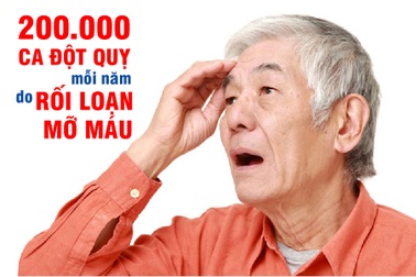 Đột quỵ - biến chứng nguy hiểm của mỡ máu cao