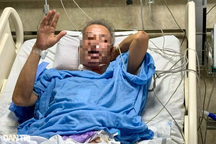 Bộ trưởng Y tế: Việt Nam "đi sau về trước" trong kỹ thuật ghép tạng