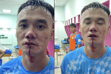 Cầu thủ hạng Nhất đánh nhau trong đường hầm sân Thống Nhất