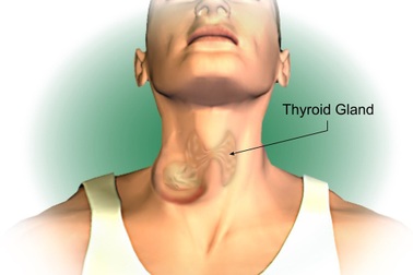 Triệu chứng ung thư tuyến giáp