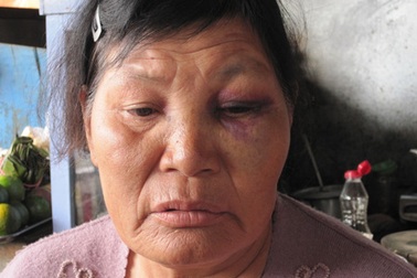 Con trai đánh mẹ bầm dập vì muốn chiếm nhà