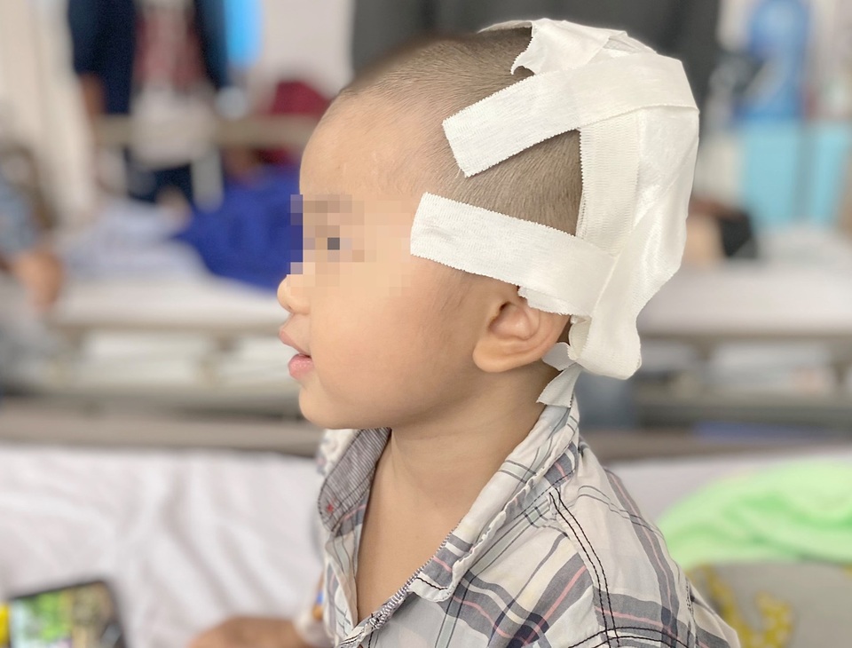 Cậu bé 2 tuổi bị lõm hộp sọ vì tai nạn nguy hiểm thường gặp - 3