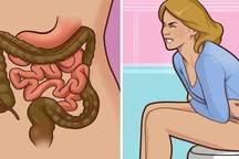 Dấu hiệu nhận biết ung thư đại trực tràng