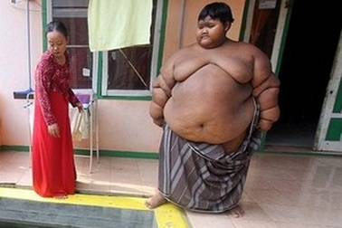 Choáng với thân hình cậu bé 10 tuổi nặng 192kg