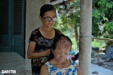 Nghẹn đắng ước mơ của cô bé bị tình địch của mẹ tạt a xít mù cả 2 mắt