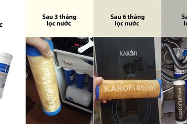 Thói quen xấu khi uống nước có thể gây bệnh tật