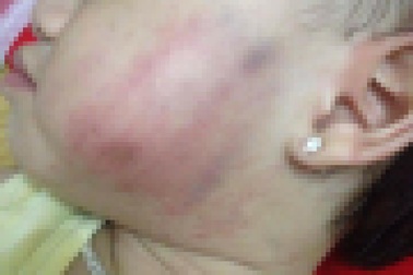 Bạo hành trẻ mầm non: Sao vẫn sa chân vào vết xe đổ?