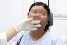 Bác sĩ Việt mổ "3 trong 1" cứu người phụ nữ Campuchia bị ngưng thở khi ngủ