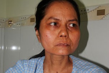 “Cô gái mang gương mặt bà lão” mắc quá nhiều bệnh