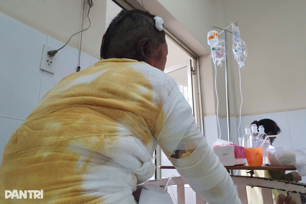 Người mẹ bị con trai tạt xăng đốt: Tôi không giận con - 2 Người mẹ bị con trai tạt xăng đốt: Tôi không giận con - 2