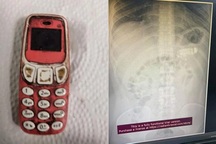 Cứu sống người đàn ông nuốt trọn... chiếc điện thoại di động